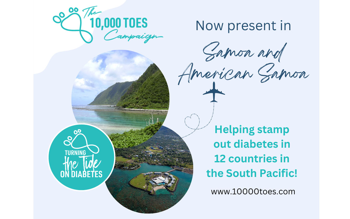 10,000 Toes is now in Samoa and American Samoa